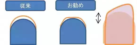 ギターを弾くための爪の形