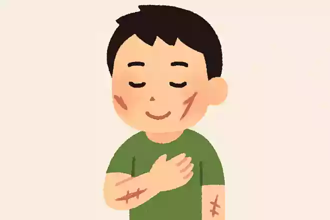 傷あとを隠しちゃいけない。その傷が君を君らしくしているんだ。フランク・シナトラ