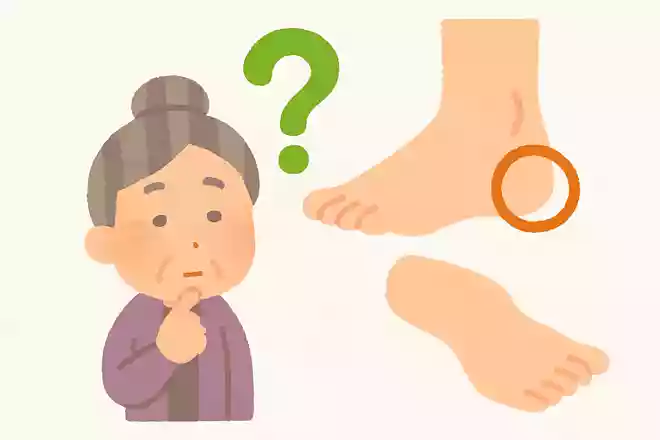 体の中で一番皮膚が厚い部分はどこでしょうか。